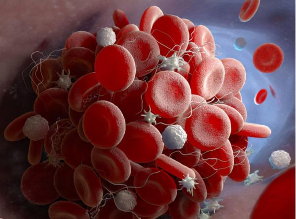 服用西地那非之前，有哪些注意事項？