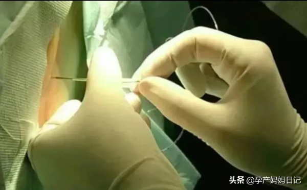 有人問如果重新選一次我會選剖還是順？我笑死我當然是選擇不生了