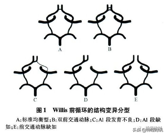 Willis環丨超細解剖+超全變異