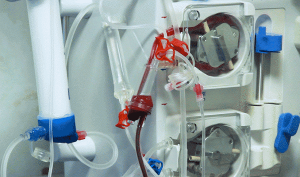 免疫淨化對類風溼患者有何幫助？給血液洗洗澡也能促進康復