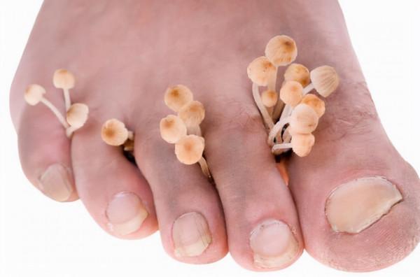 老人是面板病高危人群，其中4種很常見，教你如何正確應對