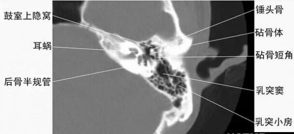 頭頸五官CT斷層解剖圖及常見病影像診斷