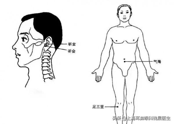 耳鳴的艾灸療法，耳鳴明顯減輕！收藏起來！有機會堅持試一試