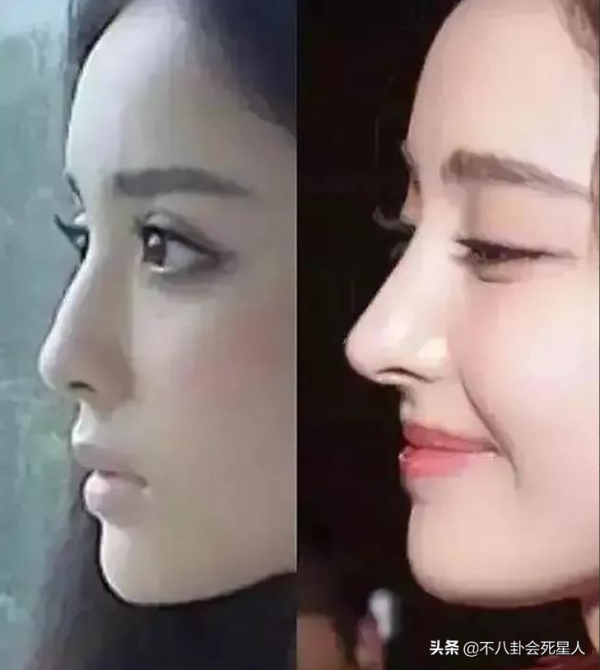 美人的臉卻敗在鼻子上？這15位女星鼻子突兀，太可惜