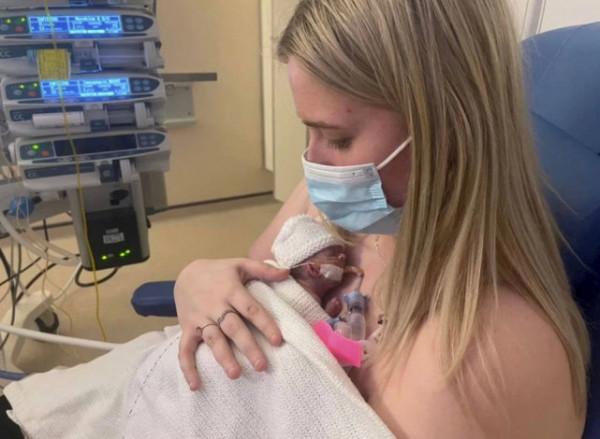 英國最小寶寶出生，體重6兩，媽媽孕25周生下，6周後長到1斤