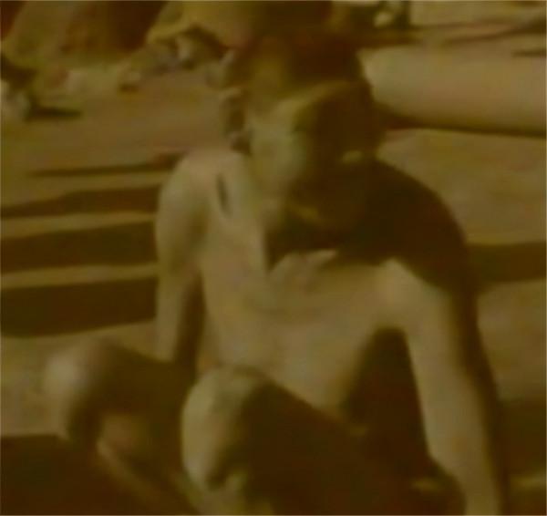 1997年，中科院對“猴娃”進行屍檢，研究者：它是小腦症患者