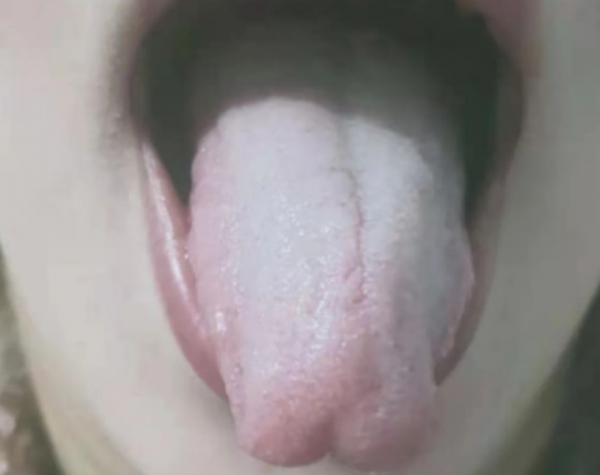 痰多難除?中醫:善治痰者,不治痰而治氣,用治氣法掃除全身之痰 痰多難除?中醫:善治痰者,不治痰而治氣,用治氣法掃除全身之痰