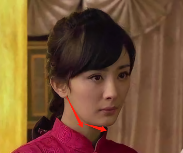 那些“一刀切”削臉的明星還好嗎？有的已垮掉，小方臉成最後贏家