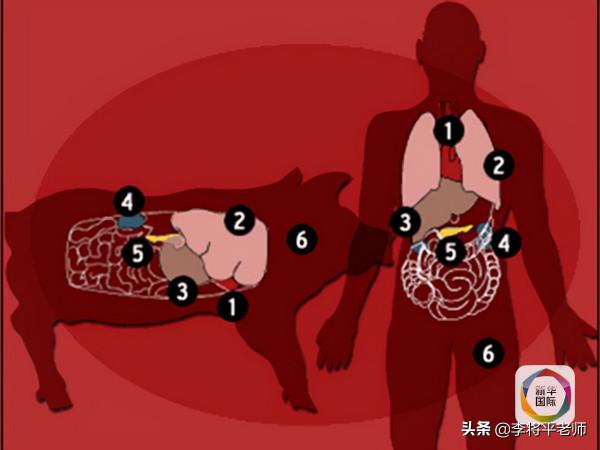 我們的腰子有救了?豬腎移植人體後正常工作,人類將自然老死嗎 我們的腰子有救了?豬腎移植人體後正常工作,人類將自然老死嗎