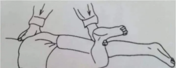 腰椎間盤突出的體格檢查 腰椎間盤突出的體格檢查