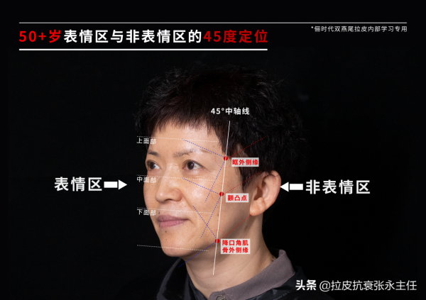 如何體現面部高階感?你需要了解45°表情區和非表情區 如何體現面部高階感?你需要了解45°表情區和非表情區
