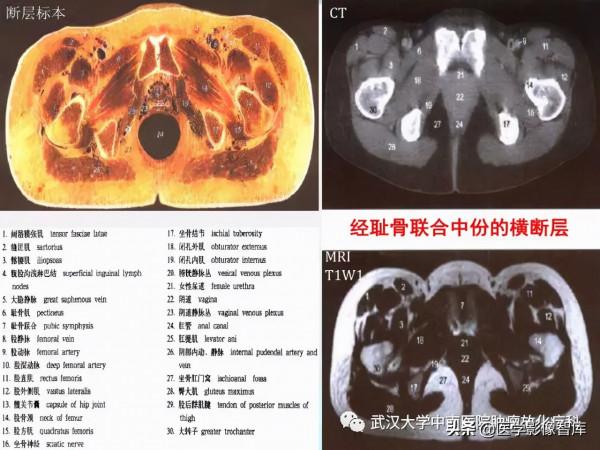 CT斷層解剖圖譜最全總結「推薦收藏」 CT斷層解剖圖譜最全總結「推薦收藏」