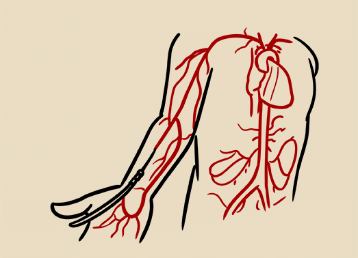 心血管疾病常用的6種檢查方法，這篇全說透了
