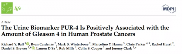 一次尿檢,預判5年內癌症進展風險!這種新技術你瞭解嗎? 一次尿檢,預判5年內癌症進展風險!這種新技術你瞭解嗎?