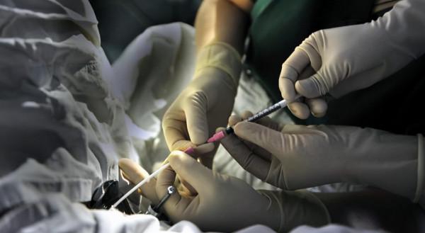 人類與猩猩基因相同？女科學家為驗證以身試險，精神值得敬佩