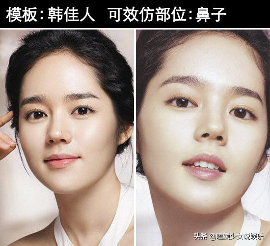 從圓臉到錐子臉再到小方臉，近20年娛樂圈審美是被誰帶偏的？