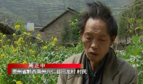 貴州出現“鬼剃頭”現象，村民集體脫髮，專家調查後也開始脫髮