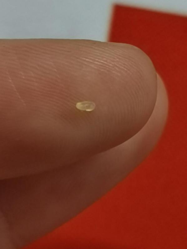 千元眼霜用完長了密密麻麻的脂肪粒?真的是眼霜的問題嗎? 千元眼霜用完長了密密麻麻的脂肪粒?真的是眼霜的問題嗎?