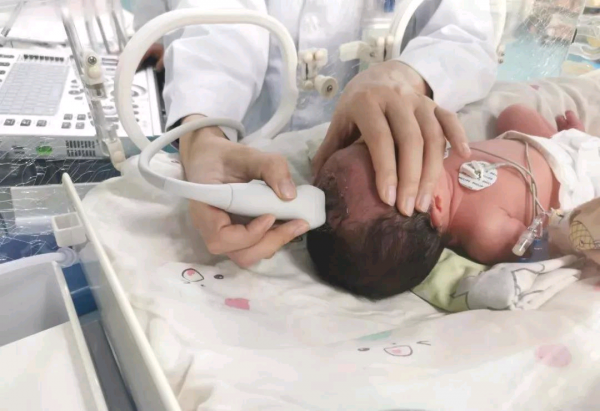 “綠色檢查”,護佑新生——新生兒顱腦超聲檢查 “綠色檢查”,護佑新生——新生兒顱腦超聲檢查