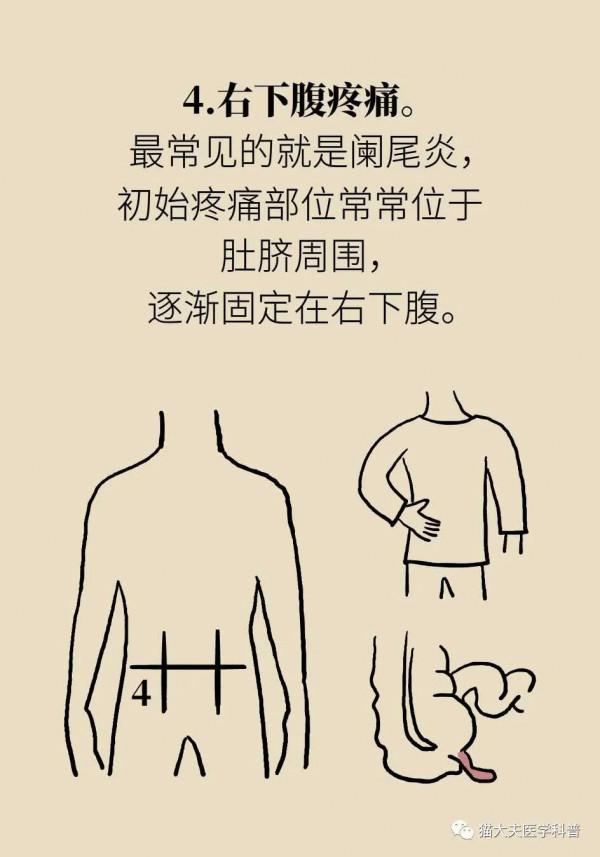 腹痛病因知多少？| 醫學小漫畫