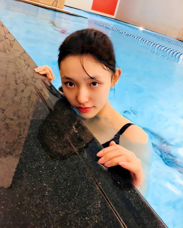 “星女郎”林允曬微整影片，針孔滲血珠，臉部浮腫，網友：太狠了