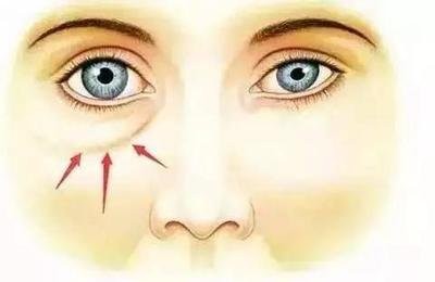 30多歲的女人長皺紋不用慌，用這幾個小妙招！皺紋還會爬上臉？