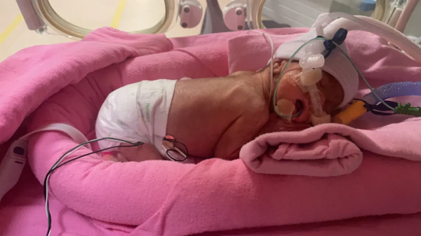 “我的孩子在新加坡早產,只有1kg重!面臨35萬天價賬單......” “我的孩子在新加坡早產,只有1kg重!面臨35萬天價賬單......”