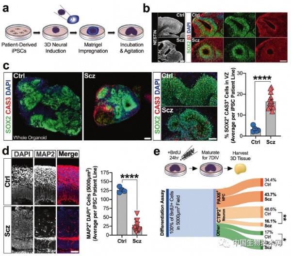 精神分裂症是從何時開始的？科學家首次揭示“孃胎裡”的遺傳線索
