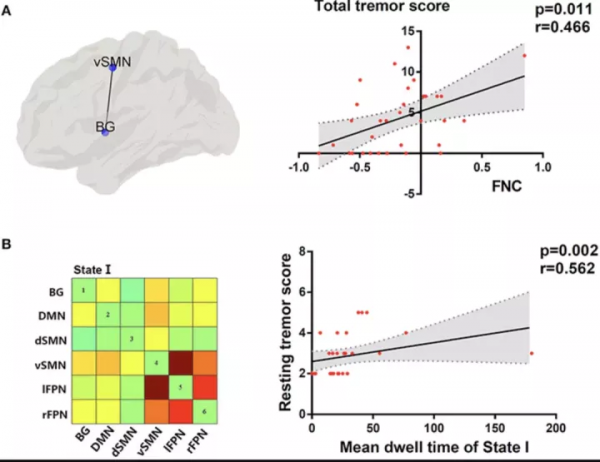 帕金森病亞型腦功能網路的改變