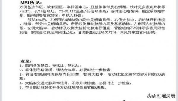 麝香保心丸治療不穩定型心絞痛的思考