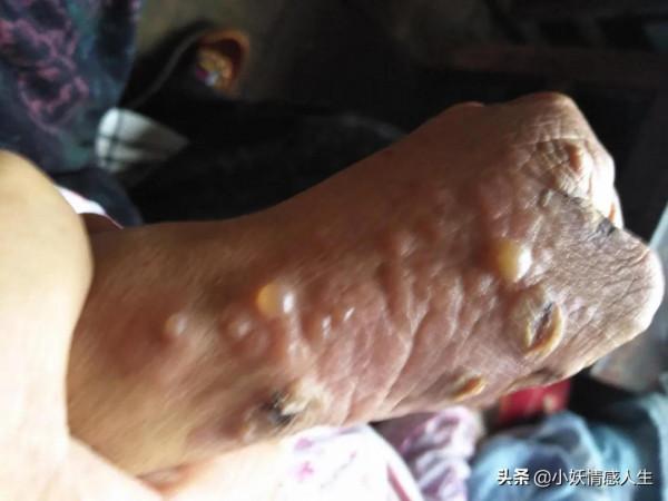 爺爺的孩子少了一個，那天我在靈前哭的撕心裂肺……