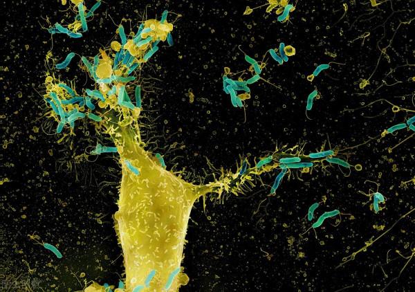 體檢查出了幽門螺桿菌,吃了半個月藥,再查還是陽性,怎麼辦 體檢查出了幽門螺桿菌,吃了半個月藥,再查還是陽性,怎麼辦