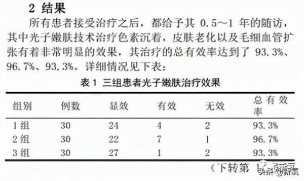 世界各國王室中，為什麼只有英國王室越來越醜？