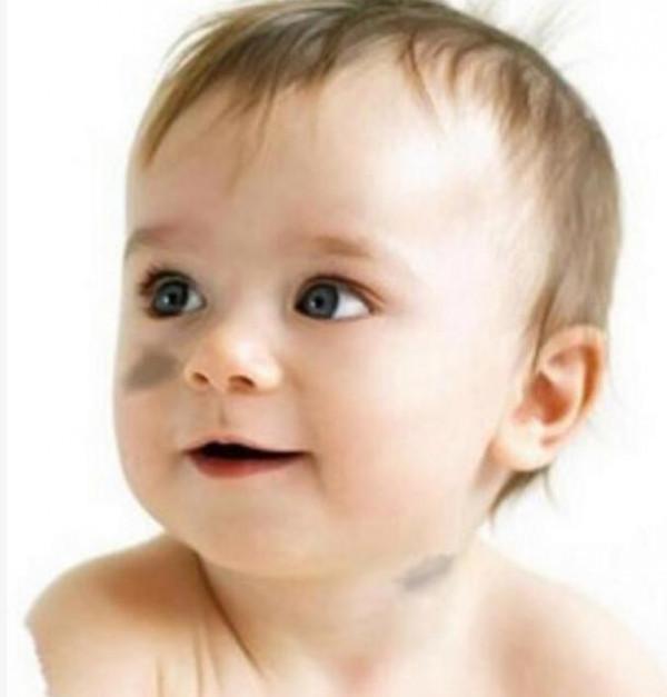 寶寶為啥會長胎記？產科醫生：孕期3種行為或易長胎記，儘量避免