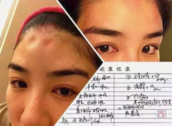 女明星薔薔曾遭男友暴打！被掐脖子打腫臉，一怒之下錘爛對方電腦