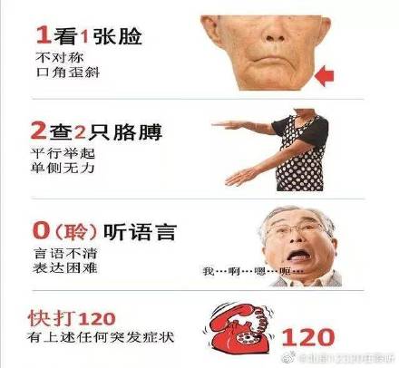 腦梗死的前驅症狀有哪些