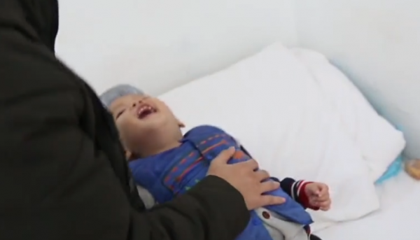 廣西2歲男孩腦部驚現巨大腦瘤,手術過程中風險重重,最後結果如何 廣西2歲男孩腦部驚現巨大腦瘤,手術過程中風險重重,最後結果如何