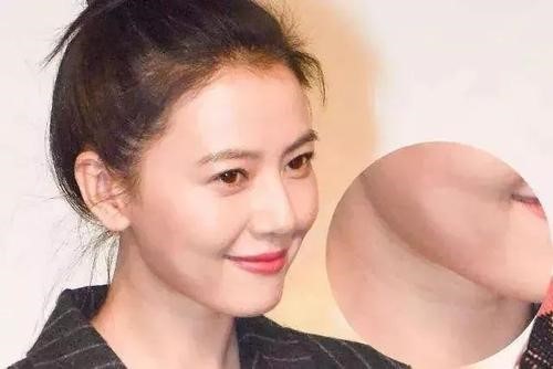 你的頸紋是否正在加速“視覺年齡”？