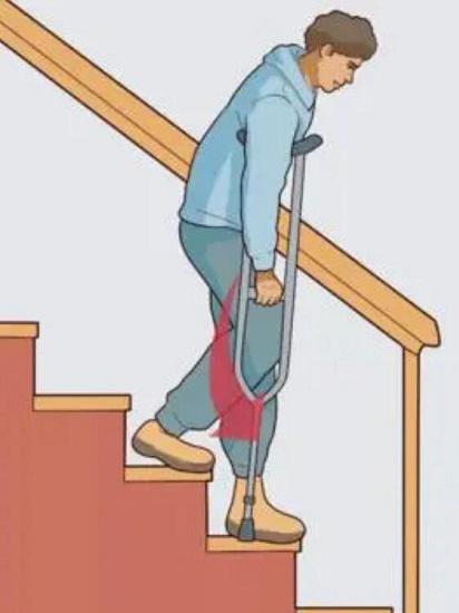 半月板損傷後的運動療法