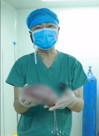 減重手術後半年,從330斤瘦到230斤 減重手術後半年,從330斤瘦到230斤