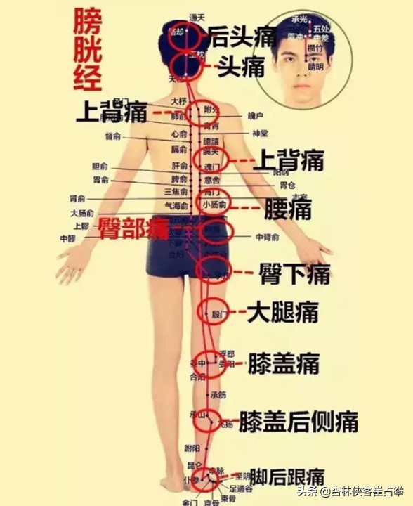 痛症總論——痛點不固定、全身痛、全身肌肉痛,三步走幫你改善 痛症總論——痛點不固定、全身痛、全身肌肉痛,三步走幫你改善