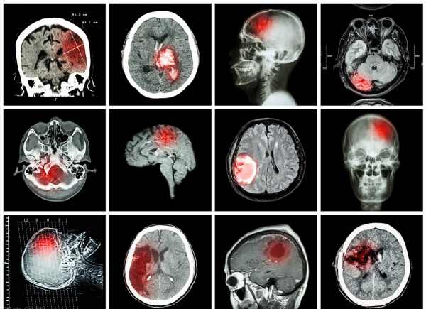 3箇中成藥，調節肝腎陰陽平衡，改善頭痛眩暈，降三高保護心血管