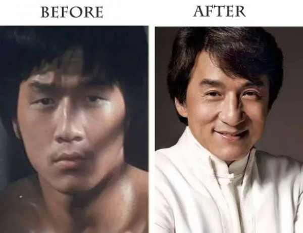 表面鋼鐵硬漢，其實也是“整容臉”！這5位影帝你真的瞭解嗎？