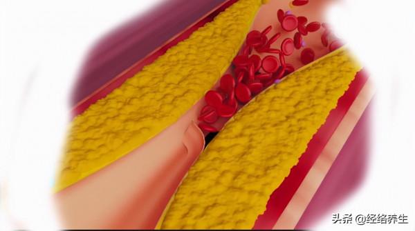 心梗的風險早知道,胃痛怎麼就變成了心梗?有這些症狀要仔細分辨 心梗的風險早知道,胃痛怎麼就變成了心梗?有這些症狀要仔細分辨