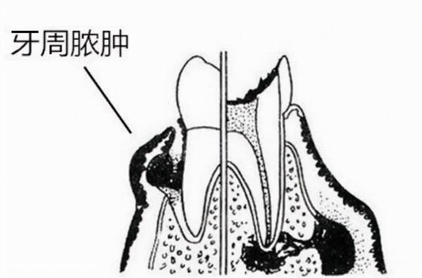 牙齦紅腫疼痛，良心牙醫給出幾個建議！輕鬆解決