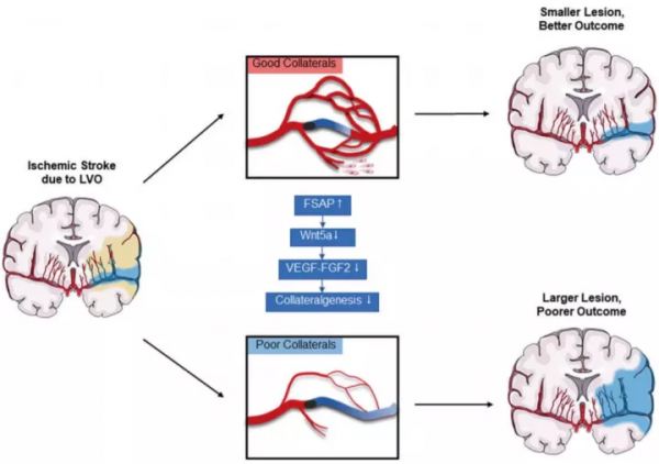 腦科學日報：華科王偉團隊發現急性缺血性中風的潛在治療靶點