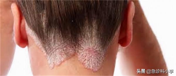 5種常見的疾病目前無法根治，千萬別被忽悠了