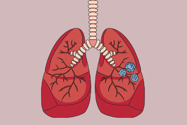 豬牛羊是結節的發物?不宜吃的是以下3種,結節患者應瞭解一下 豬牛羊是結節的發物?不宜吃的是以下3種,結節患者應瞭解一下