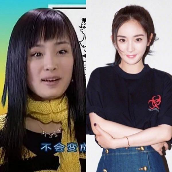 楊冪&OpenCurlyDoubleQuote;拔牙後遺症&rdquo;犯了！打臉說整容的人，粉絲：這毛病可以接受