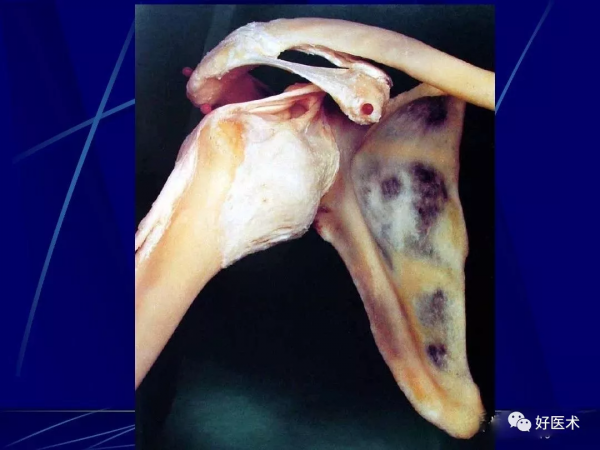 86張全身關節應用解剖精講，這篇文章值得收藏